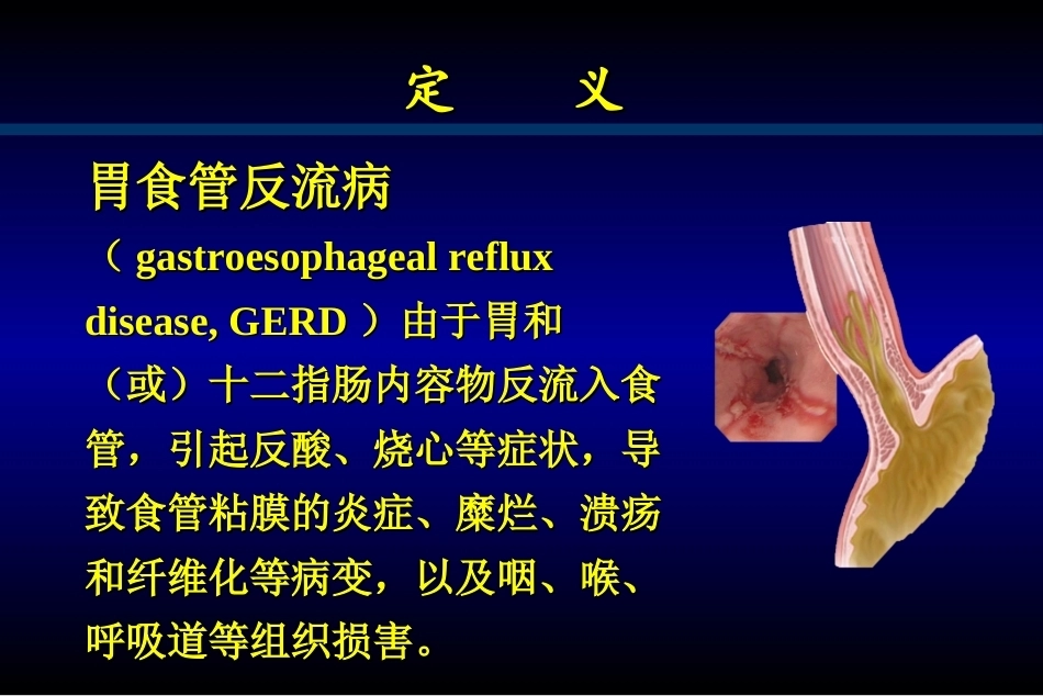 消化系统疾病教学整册课件.ppt_第3页