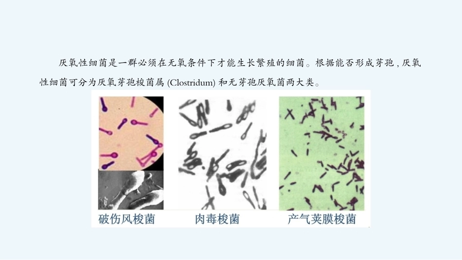 病原生物与免疫学：厌氧性细菌PPT教学课件.pptx_第3页